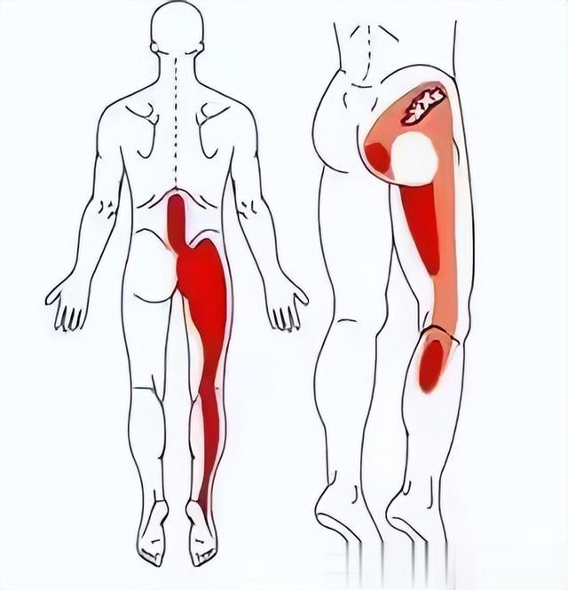 二手烟|腰椎间盘突出,是选择保守治疗?还是手术?