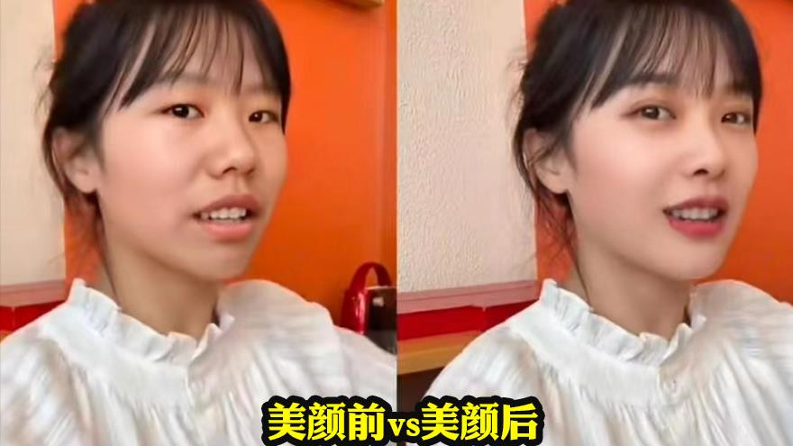 整容|“挖呀挖呀”黄老师遭遇网暴：38岁疑似整容