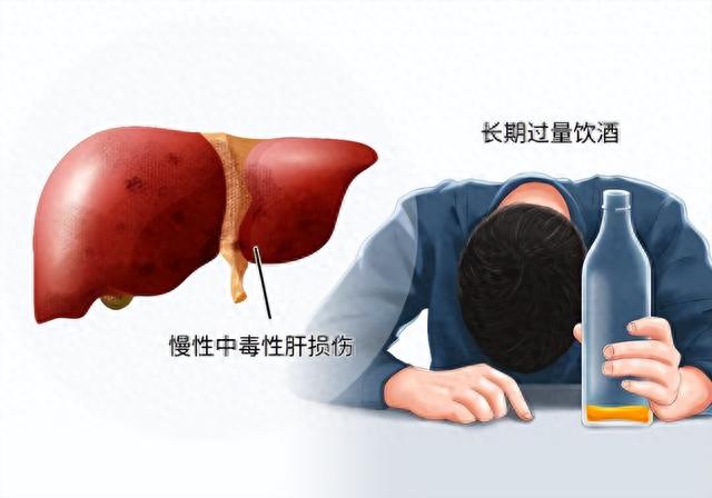 肝有问题的人，睡觉有5种反应，若一个不占，值得恭喜，肝还不错