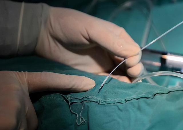 国内将逐渐停止“心脏支架”手术?做完人就不行了?科学揭秘真相