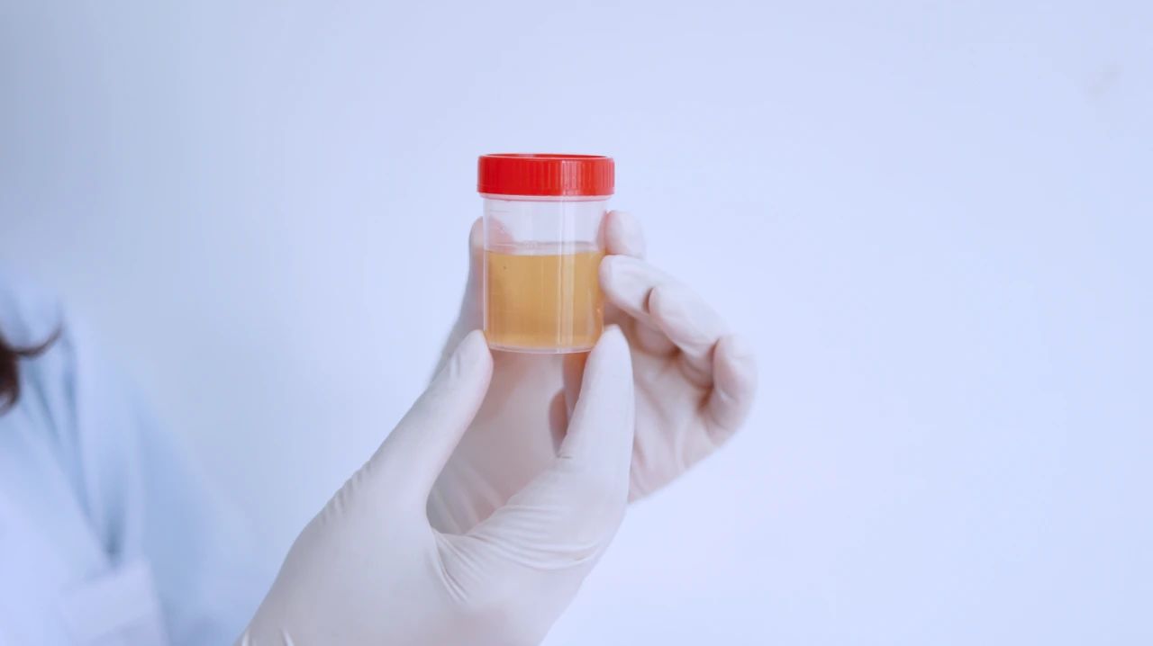 肝脏受损后，身体2处会“变黑”，2处会“变臭”，一定要警惕