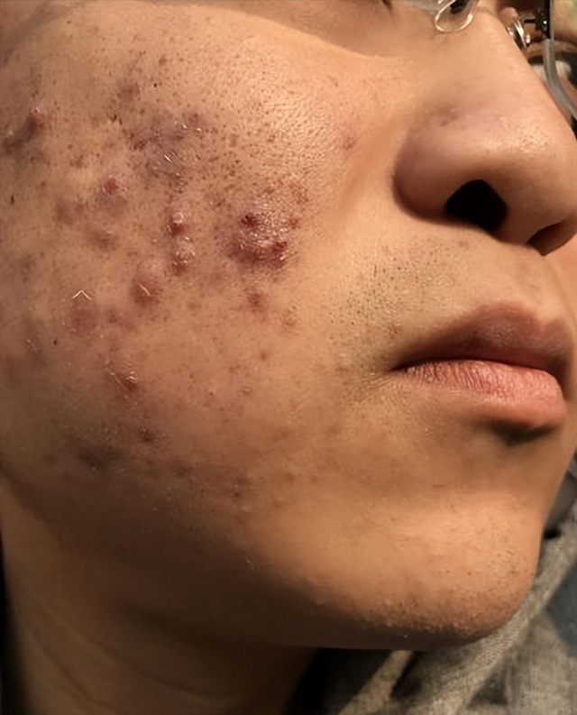 男同志喜欢“用手”,伤肝又伤肾