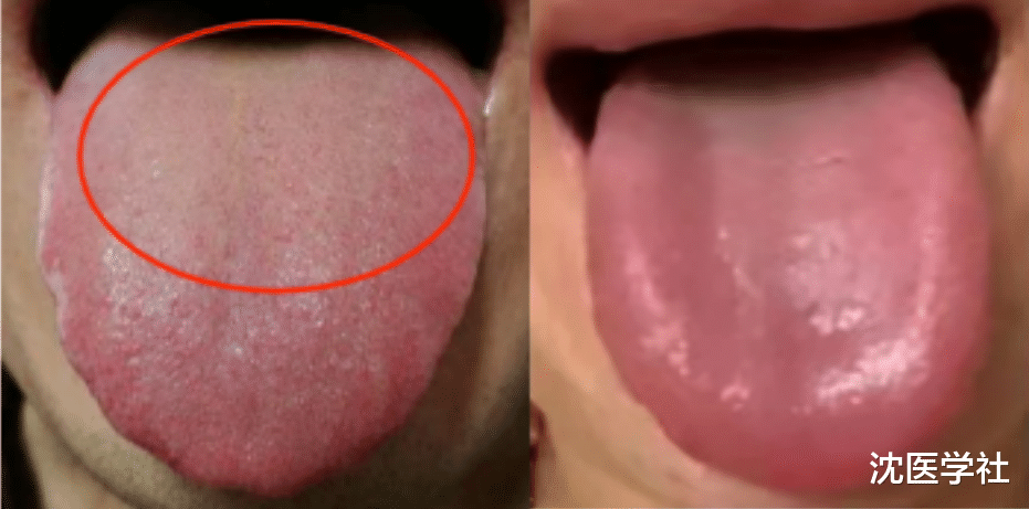 4个男科用药，胜过西地那非，让你肾足底气足，有效起萎不费劲