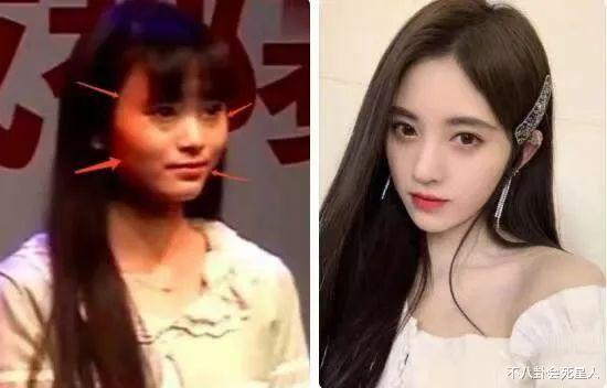 娱乐圈假鼻子扎堆,金晨新剧出戏,毛晓彤变样,把我看无语了