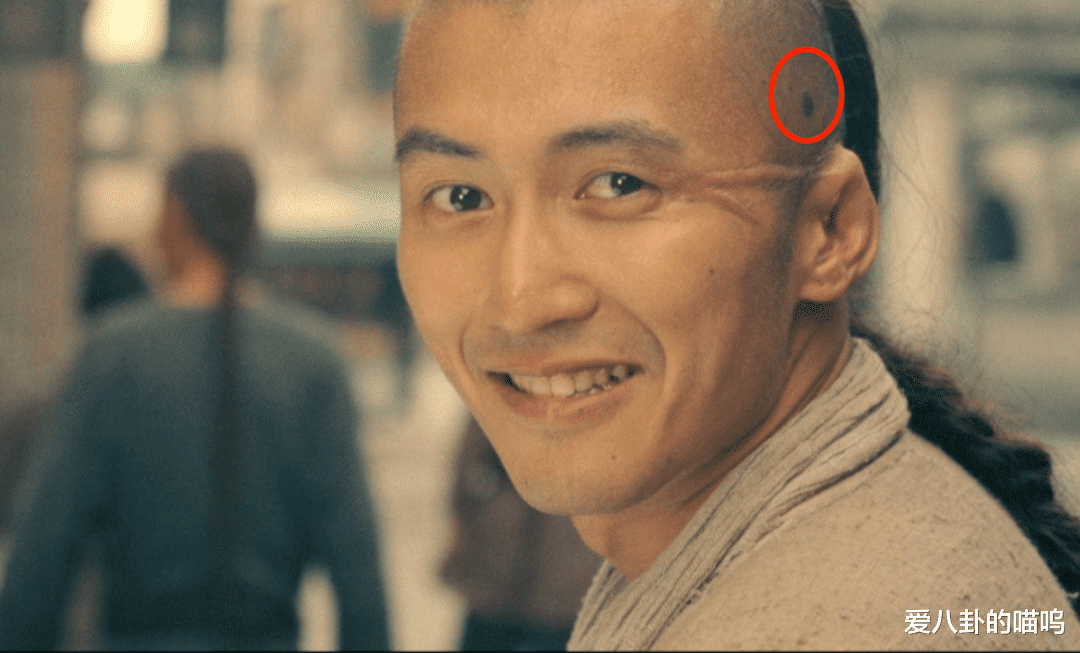 中国好声音|好声音学员张恒远因病去世,谢霆锋曾患此病,还好经纪人及时发现