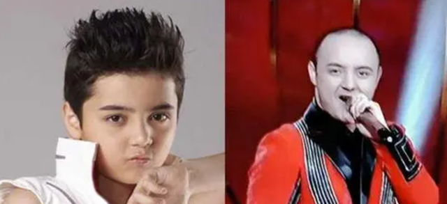 4位长残的童星,因肥胖被北影拒绝,头秃沦为路人,丑的千奇百怪