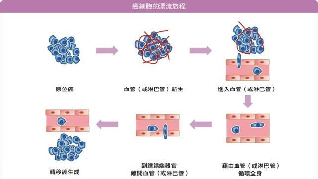 癌症复发转移？NKT-DC免疫细胞治疗，深度识别清除癌细胞