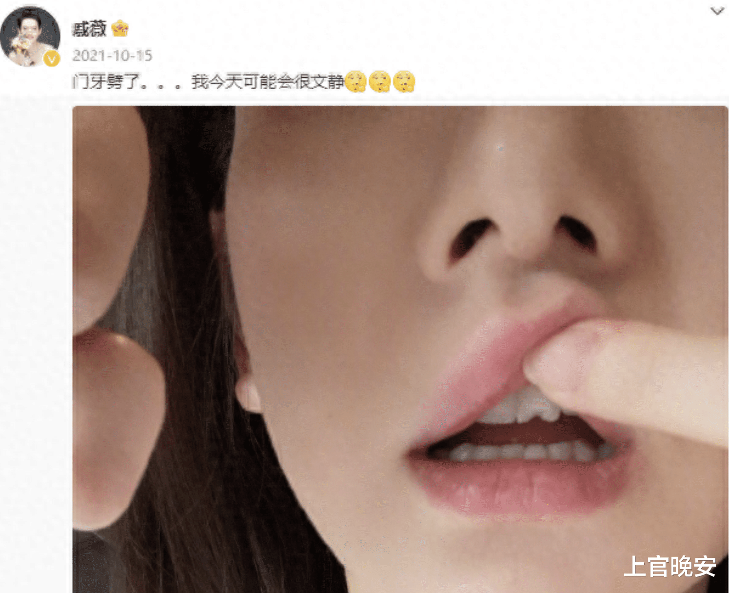 没眼看!嘴包不住牙,嘴凸,演戏难看,明星能不能放弃烤瓷牙审美