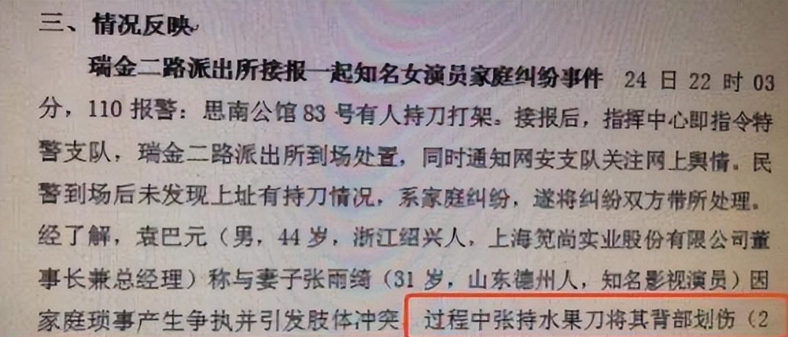 卓伟喊话大小S,曝出当年张雨绮气的扇汪小菲耳光的原因