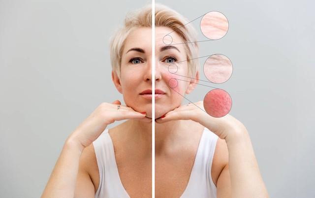 盘点十大难治愈的皮肤病!引发绝望的源泉!