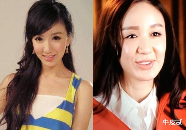 整容|有种倔强叫“我没整容”！明明从大饼脸变成V脸，真当观众瞎吗？