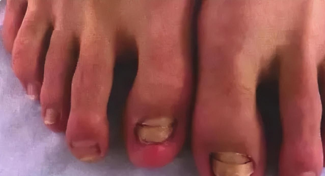 恐怖的温泉鱼疗:吃脚皮、治脚气全是假象,整条鱼进去只剩骨架