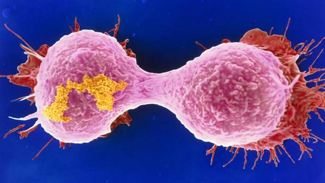 癌细胞或“讨厌”6种碱性食物，别舍不得吃，为健康助力