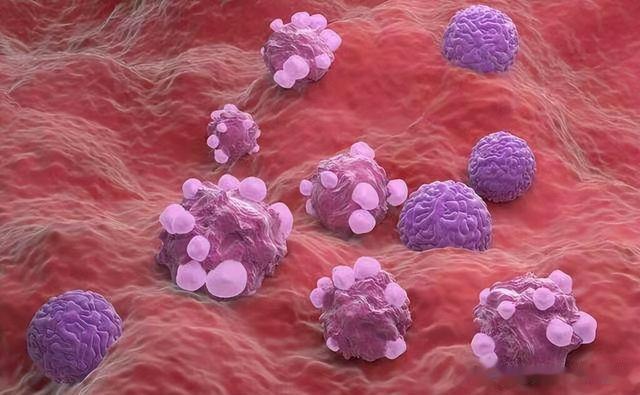 肝硬化|体内有癌，嘴巴先知？口腔出现3种迹象，可能是癌细胞“活跃”