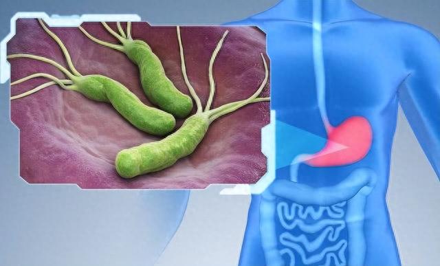 南瓜是胃病的催化剂？医生：想胃好，多4黄，喝2茶，胃或更健康