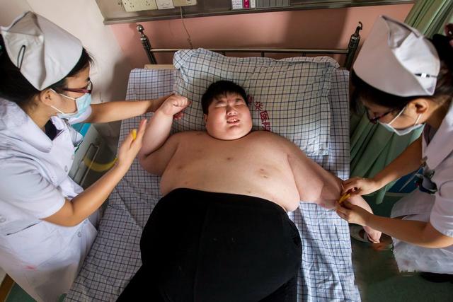 江西14岁男孩体重300斤，一顿能吃6碗饭，离世前还在哭着减肥