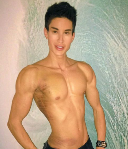 “芭比男友”贾斯汀:整形上百次,在后背植入翅膀,如今怎样了?