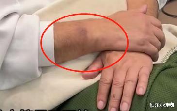 丢人!曝乔任梁去世系父母杀生过度,乔爸道歉,长黑斑健康引担忧