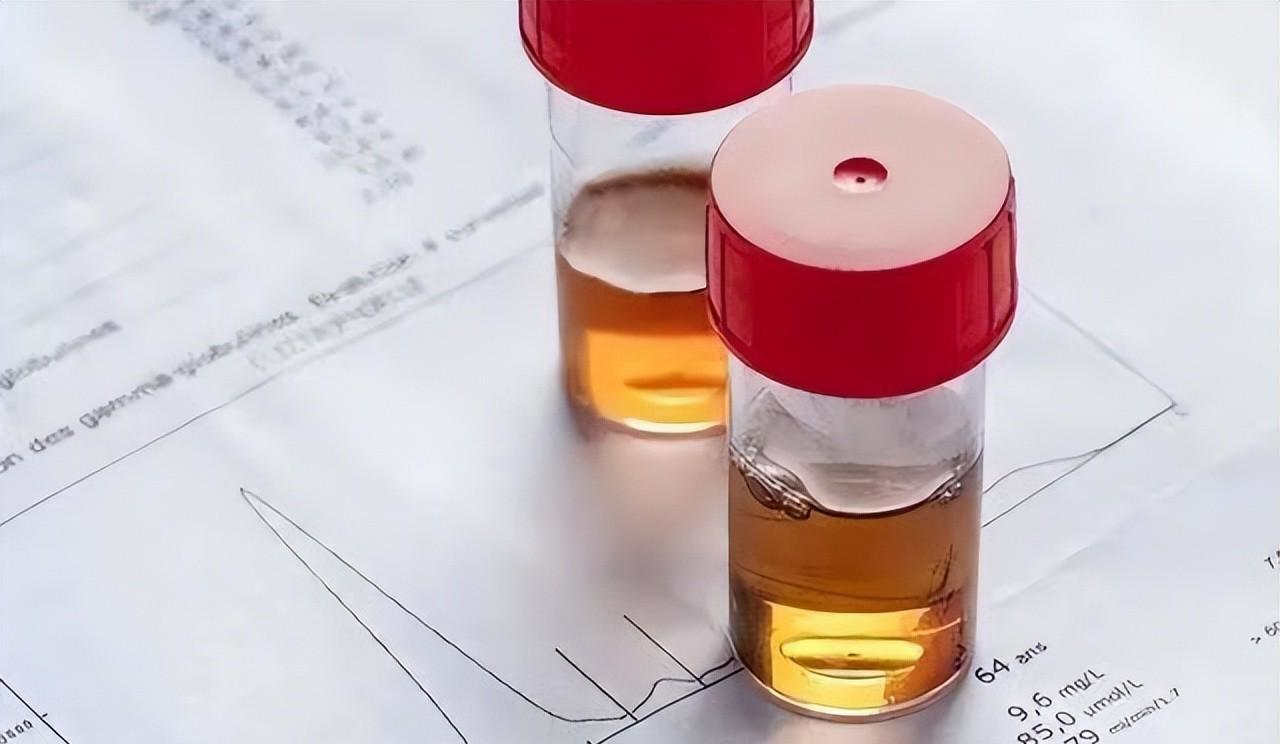 脑积水|40岁男子痛风发作，查出肾衰竭，提醒：2种食物加速恶化，管住嘴