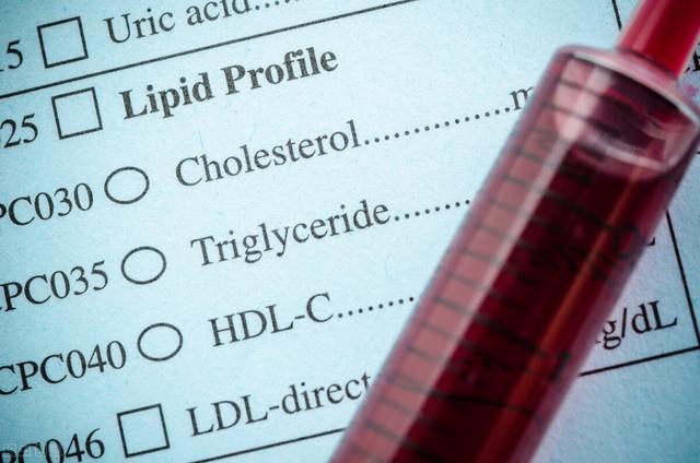 静脉血栓|胆固醇、甘油三酯都属血脂，哪一项更重要？心血管医生告诉你答案