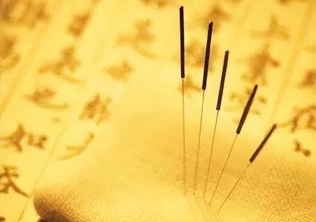 感冒|中医秘术“鬼门十三针”，到底有没有科学性？看下专业的分析