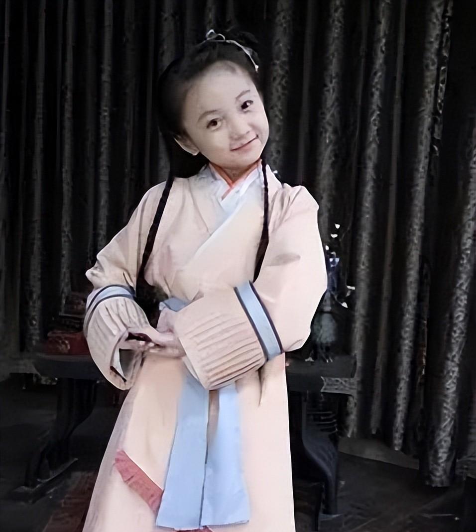 九位长“残”的童星:因为肥胖被北影拒绝,头秃沦为路人,丑态各异