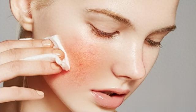 入秋敏皮修护面霜怎么选，这4款真的可以修复肌肤！