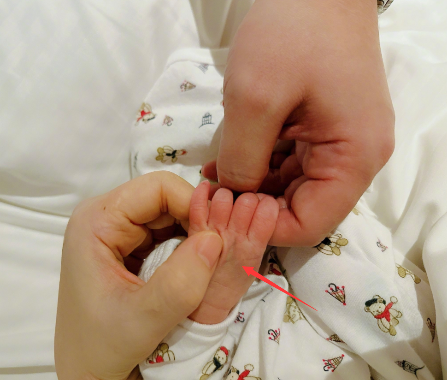 Selina顺产生下儿子,小腰果肺积水住进保温箱,插管治疗小手淤青