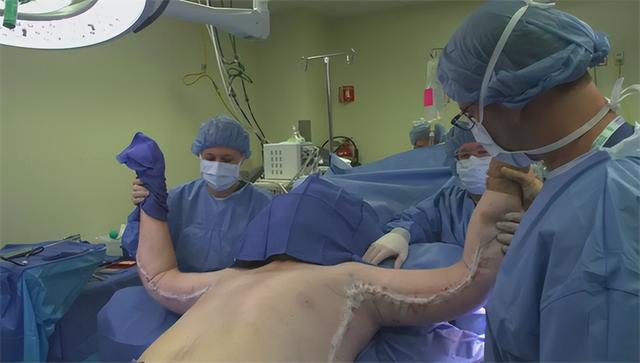 他体重曾达1016斤，喝毒药都被肥肉吸收，医生：死后得送去屠宰场