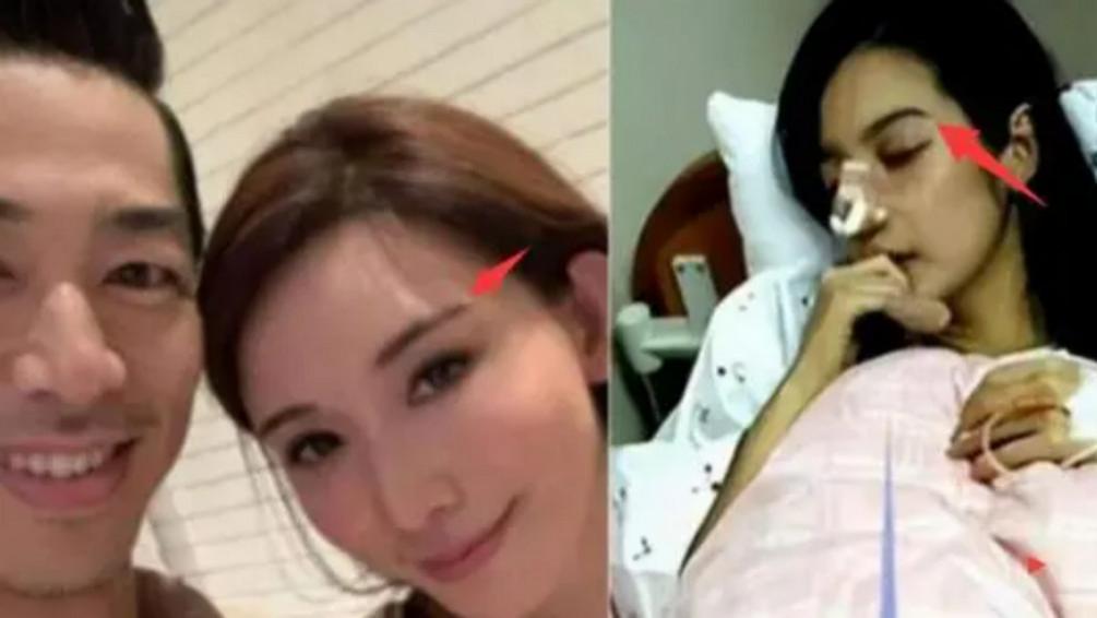 林志玲|下嫁日本的林志玲终究要为自己的选择买单，假体被打掉，重伤住院？