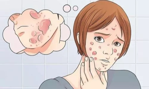 毛孔大黑头多用什么洗面奶好