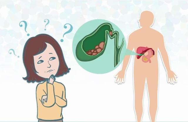 手术切除“胆囊”，会有哪些后遗症？医生说出真相，看完涨知识了