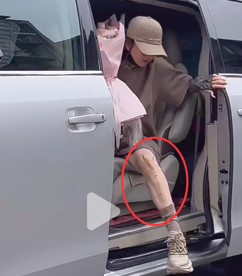 杨丽萍|65岁杨丽萍再惹争议!随手扔垃圾被批没素质,腿部满是疤痕太抢眼