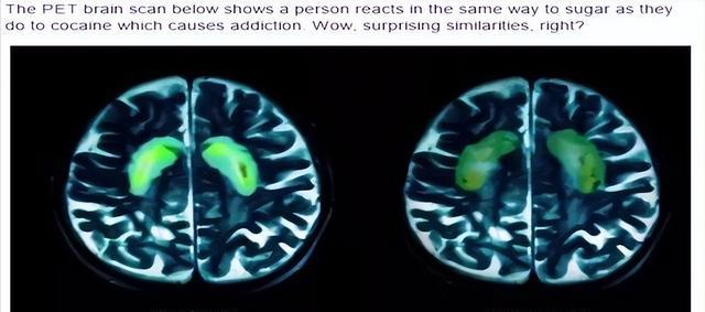 面食|面食等主食，最容易发胖的食物，很多人每天吃好几碗