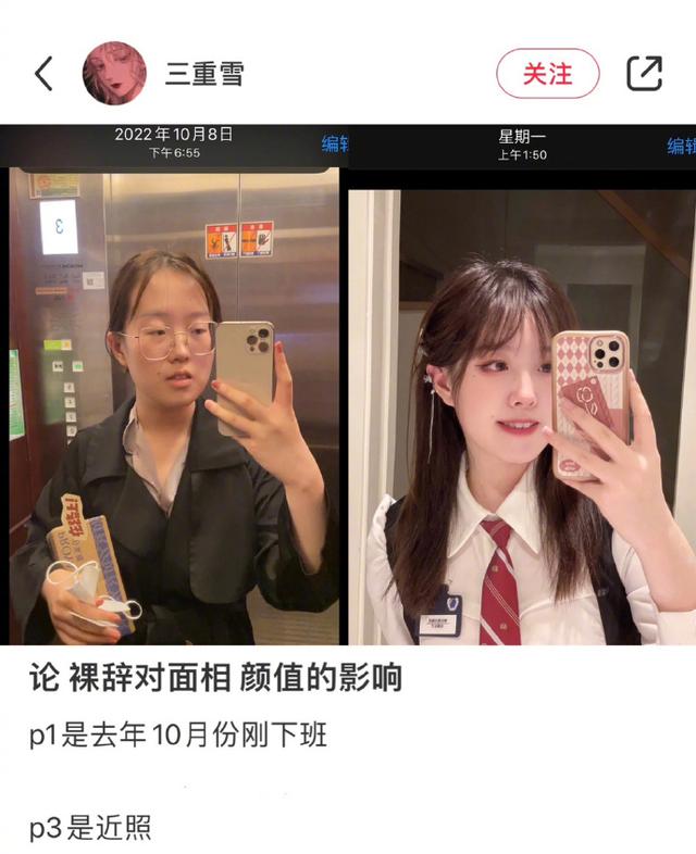 穿衣搭配 “离职，更适合中国宝宝的医美”