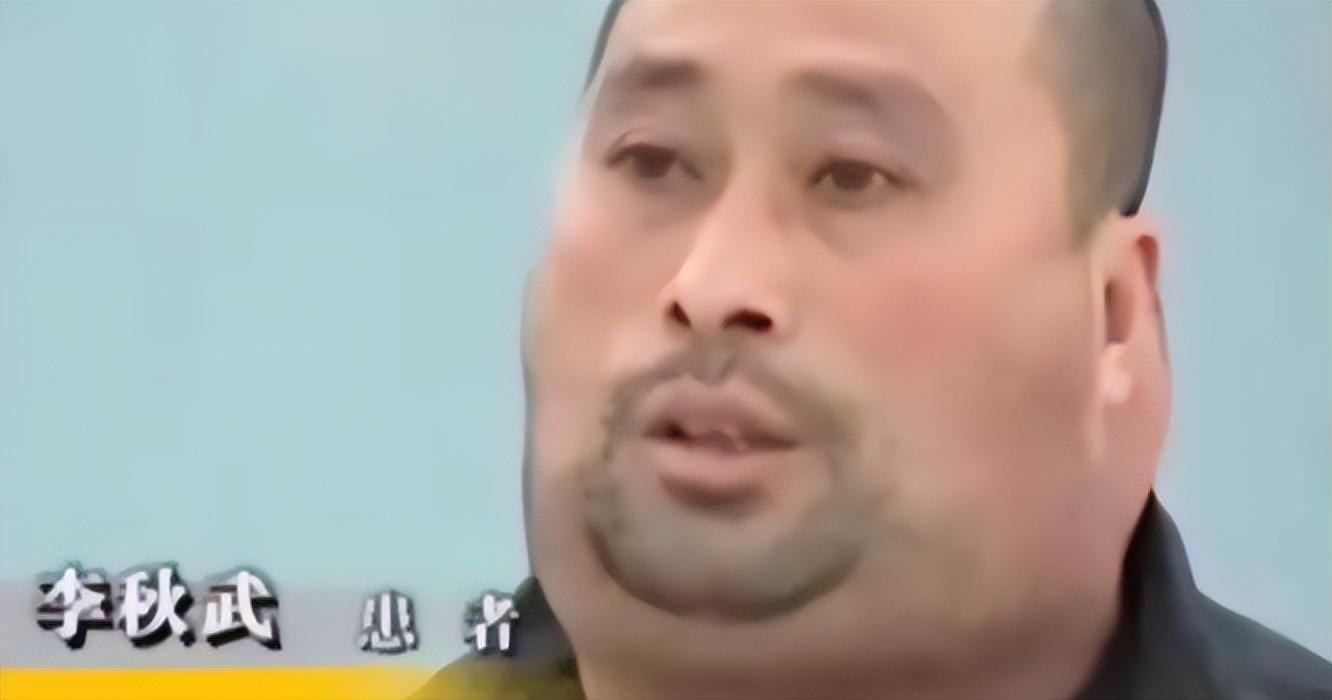 46岁男子20年喝了两万斤酒，脖子变成河马脖，总量至少有8700斤