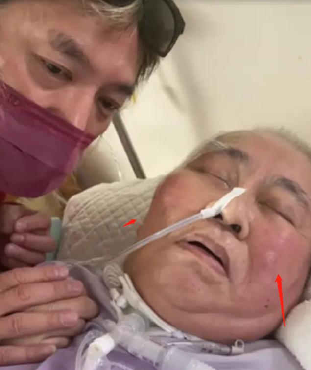 李坤城|反转！李坤城临终照曝光，全身浮肿似气球，邻居出面曝儿子真面目