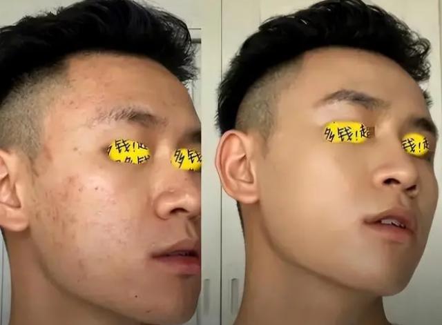 肌肤 长期用硫磺皂洗澡的男生,现在都有什么变化?建议早点知道