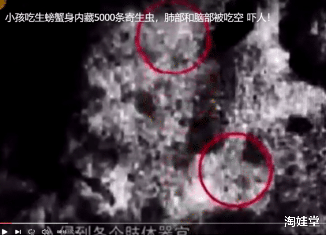 5000条虫子啃空娃脑肺!不要再喂娃吃了,多数宝妈不注意