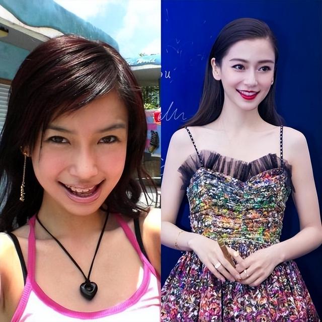 整容|长得“歪瓜裂枣”,整得“如花似玉”,这些女星都靠脸逆天改命