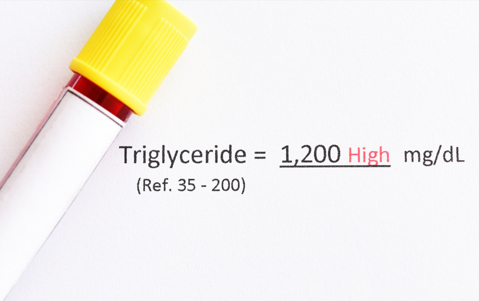 提醒：血脂高的人，若有这7个习惯，要尽早改掉，对降血脂有利