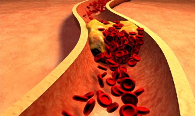 最新胆固醇含量排行榜公布,鸡蛋位居末尾,第一名尽量少吃