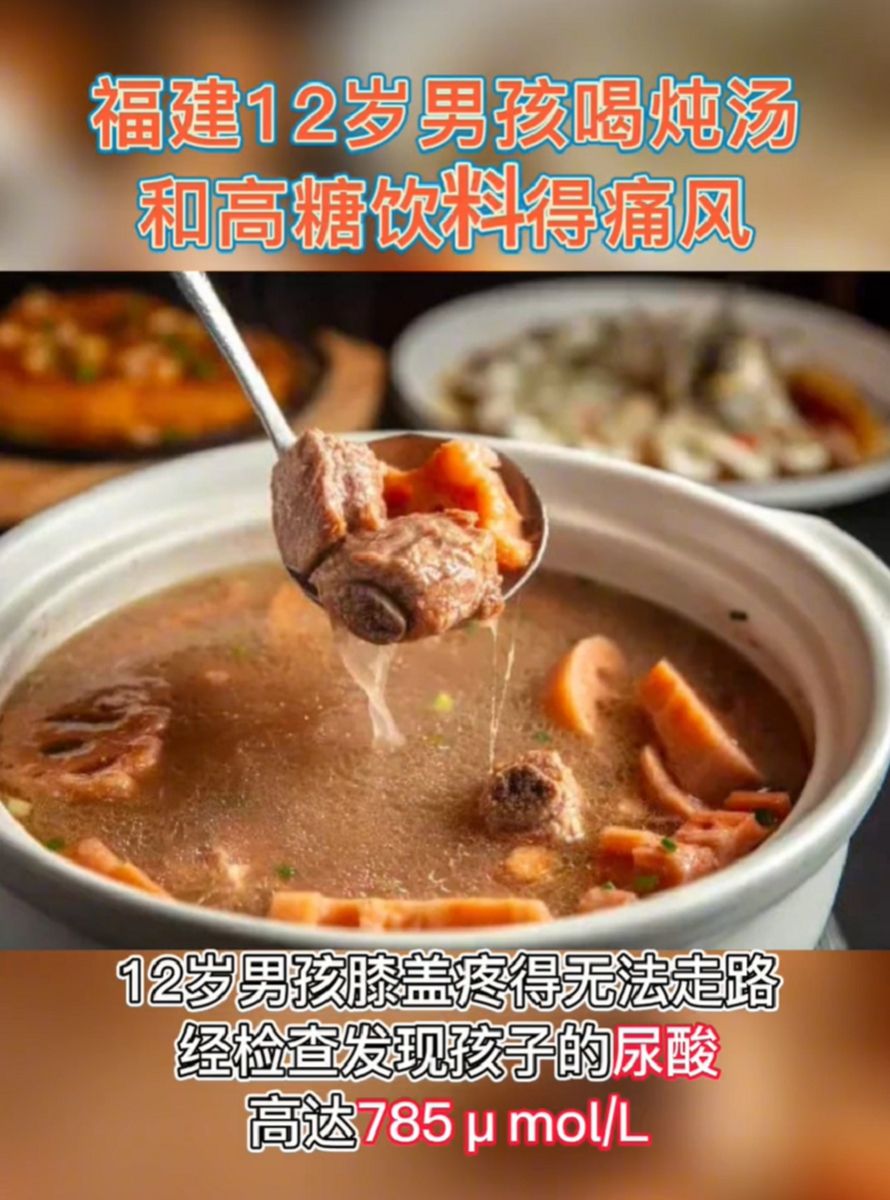 儿子患“痛风”和奶奶做的饭菜有关,提醒:3种食物要少给孩子吃