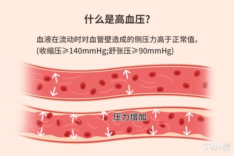 实锤!运动降压并非假话,研究已证明,这1种运动降压效果最好