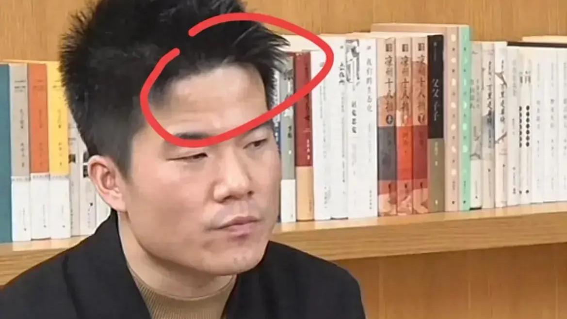 董宇辉露面！一夜苍老10岁，公开挽留孙东旭，脑门凸起大包引担忧