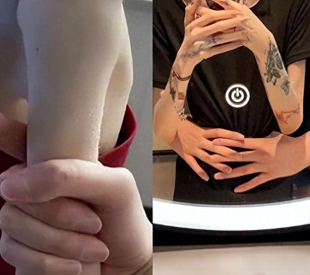 她被男友PUA、排泄难控穿纸尿裤！如今瘦成“皮包骨”，体重60斤