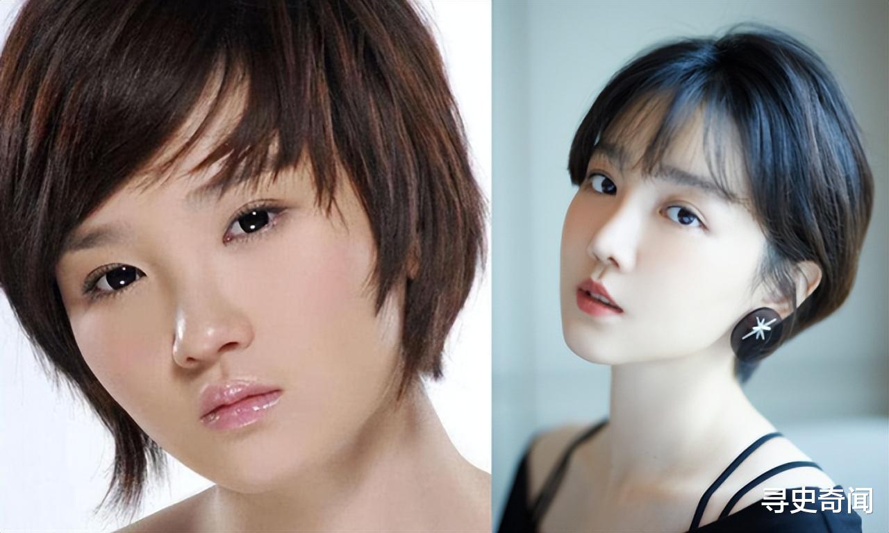 整容 整容成瘾、瘦成病态，娱乐圈里的“畸形”审美，什么时候到头？