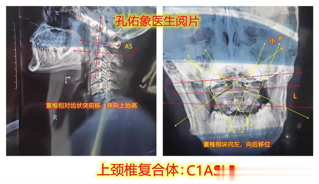 体内有病，头颈先知？提醒：总是头晕，或是这4种病在“求救”