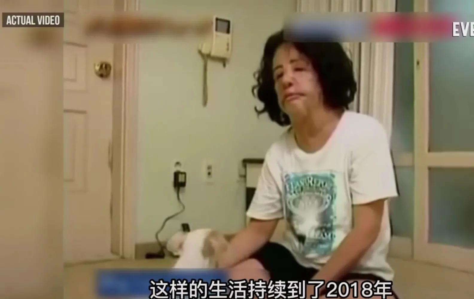 韩慧景|28岁女歌星整容成瘾!缺钱整容自己动手:脸上注射香油和水泥!