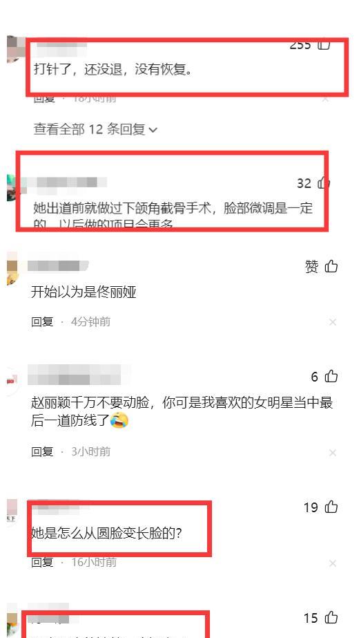 赵丽颖|赵丽颖近况惹争议，张嘴困难疑似整容失败